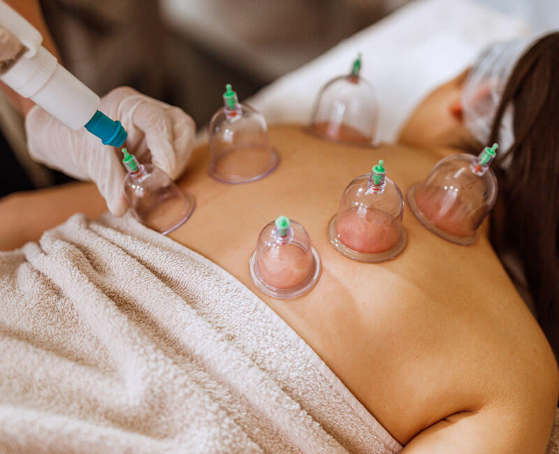 Vacuum Cupping